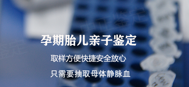 山西怀孕几个月需要怎么办理孕期亲子鉴定,山西做无创孕期亲子鉴定多少钱 山西怀孕几个月需要怎么办理孕期亲子鉴定,山西做无创孕期亲子鉴定多少钱